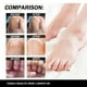thumbnail image 5 of Fungal Care Fluid Gel eficaz para eliminar hongos en el cuidado de los pies (30ml), 5 of 6