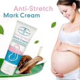 thumbnail image 5 of 2x Removes Stretch Mark Cream Pregnant Women Repair Anti-aging Anti-winkles Cream Increase Skin Elasticity Smooth Firm Skin Care, 5 of 5