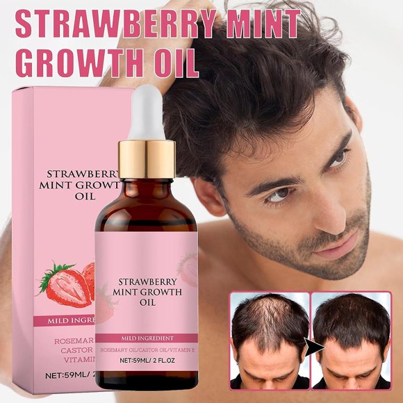 Strawberry Mint Hair Growth Oil and Natural Rosemary Hair Growth Essence, suitable for dry, damaged and thin hair.