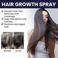 thumbnail image 3 of 2pcs Hair Growth Spray Moisturizes Scalp Hair Damaged Strong Hair Dense Hair Growth Spray, 3 of 4