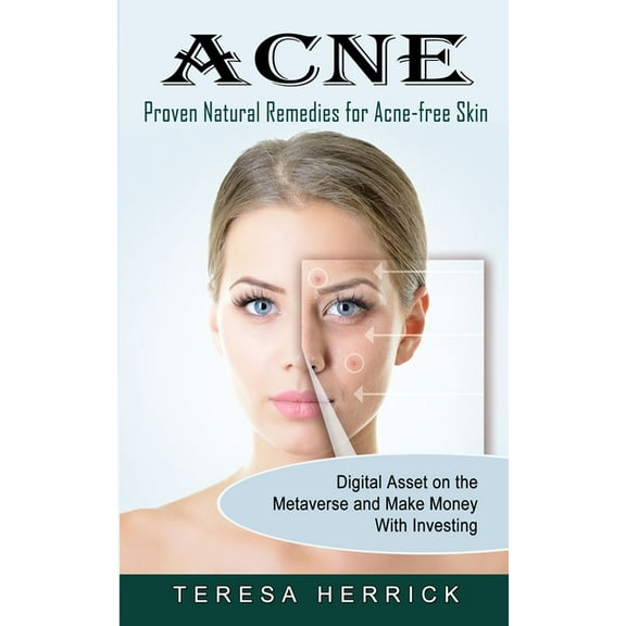 Acne: Proven Natural Remedies for Acne-free Skin (Learn About the Most Recent Updated Natural Acne), (Paperback)