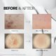 thumbnail image 3 of Set de Cuidado de la Piel VT COSMETICS Reedle Shot 10ml x3 Anti-Envejecimiento, 3 of 6