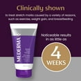 thumbnail image 3 of Mederma Stretch Marks Therapy, Helps Prevent and Treat Stretch Marks, 5.29 Ounce, 3 of 8