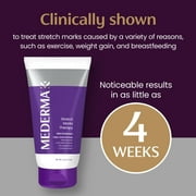 Mederma Stretch Marks Therapy, Helps Prevent and Treat Stretch Marks, 5.29 Ounce