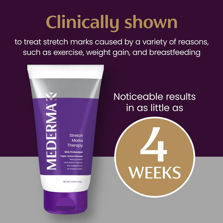 Mederma Stretch Marks Therapy, Helps Prevent and Treat Mederma Stretch Marks Therapy, Helps Prevent and Treat