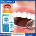 thumbnail image 3 of 3PCS Jorondy Teeth Mouthwash,30ml Herbal Brightening Oral Repair Foam Deeply Cleaning, 3 of 5