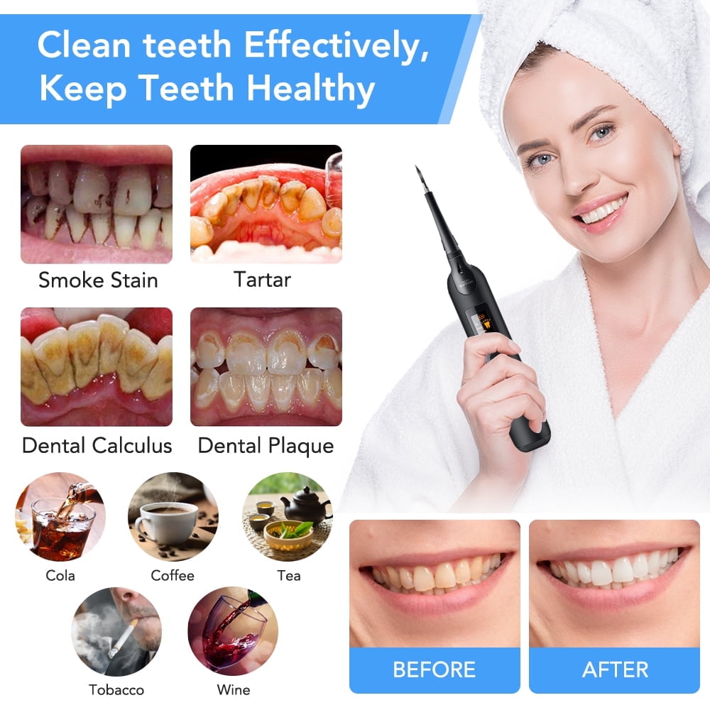 Sonic Tooth Scraper, Electric Dental Calculus Remover With 5 Adjustable Modes, Powered by USB, Scraper Plaque Tartar Remover Teeth Cleaning Tools for Dental Calculus, Tartar, Tooth Stains