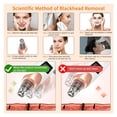 thumbnail image 6 of XIRQI Pore Vacuum,Usb Rechargeable Blackhead Remover Vacuum,3 Levels Adjustable Pore Vacuum Blackhead Remover,With 5 Suction Power,6 Probes,Face Vacuum Pore Cleanser for Women And Men (White), 6 of 7