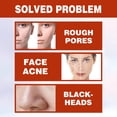 thumbnail image 2 of Suero facial de 30ml ácido salicílico hidratante esencia nutritiva para la piel productos de belleza JShteea Cuidado Belleza, 2 of 9