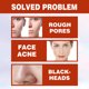 thumbnail image 2 of Suero facial de 30ml ácido salicílico hidratante esencia nutritiva para la piel productos de belleza JShteea Cuidado Belleza, 2 of 9