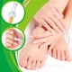 thumbnail image 1 of Pluma De Tratamiento De Uñas 5ml 1 ANGGREK Nail Fungal Pen, 1 of 7