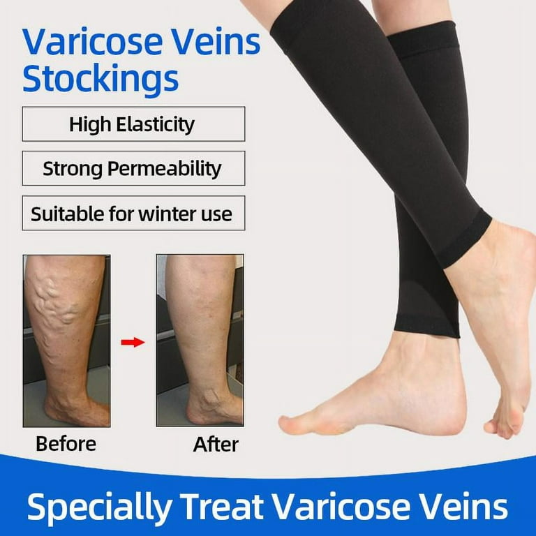 Prevent Calf Varicose Veins Compression Sock Medical Grade One Pressure  Treat Varicose Leg Women Slim Socks Black Flesh-colored 