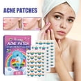 thumbnail image 6 of Pimple Patches,Clearance,Pimple Patch 216 Counts Patch With Star-Shaped Spots Healing Patch Zit Patch, 6 of 9