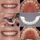 thumbnail image 4 of A Pair Upper & Lower High Quality Denture Instant Smile Comfort Fit Flex Cosmetic Teeth Denture Teeth Top Cosmetic Veneer High Quality Bdliv, 4 of 5