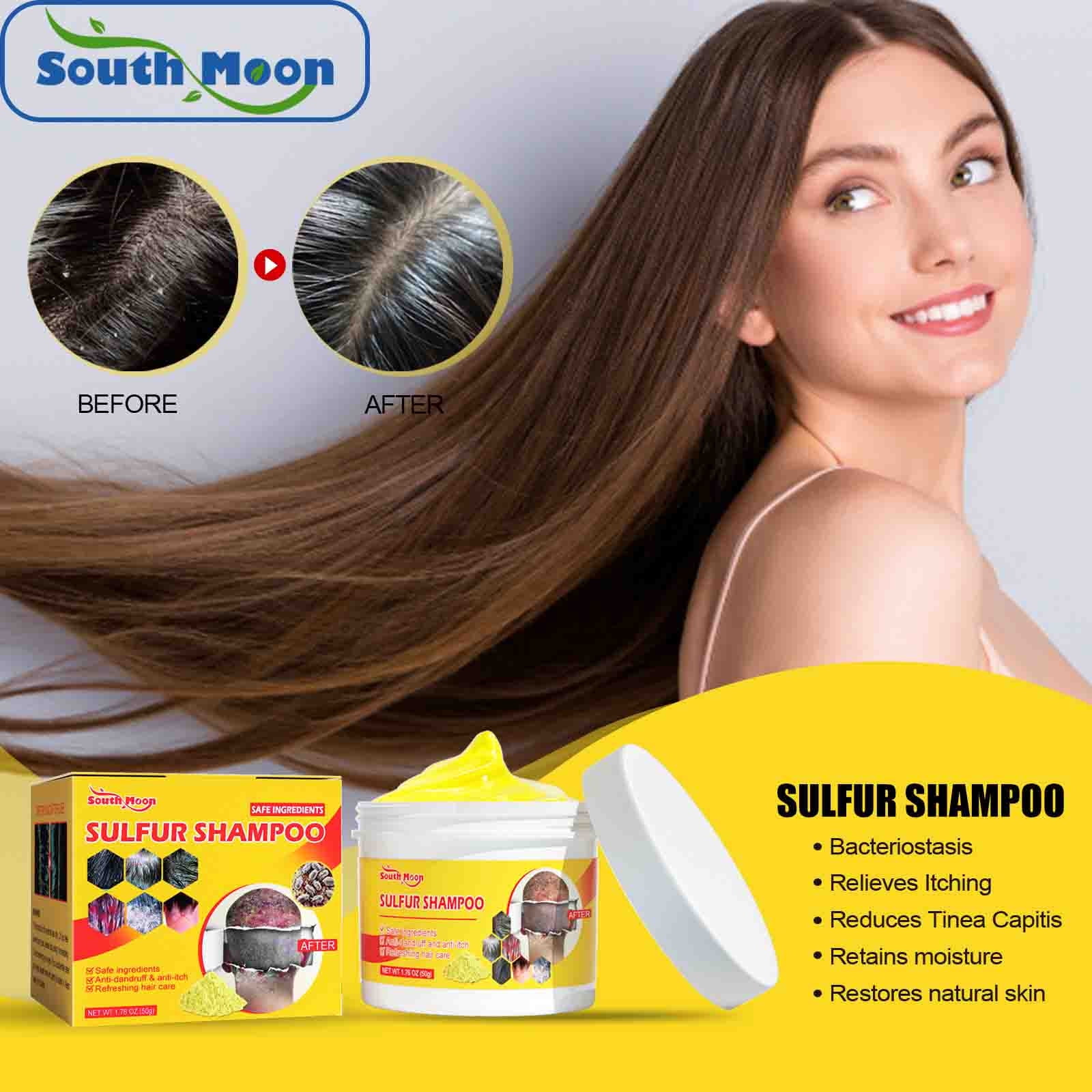 Sulfur Shampoo For Removing Lice, Relieving Itching, Controlling Oil,  Cleaning Hair Follicles, Removing Mites And Pimples, Scalp Care 50g -  
