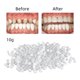 thumbnail image 2 of Kit de reparación temporal de dientes Reparación de dientes de moldeo térmico Accesorio de reemplazo TFixol Reparación de dientes, 2 of 7