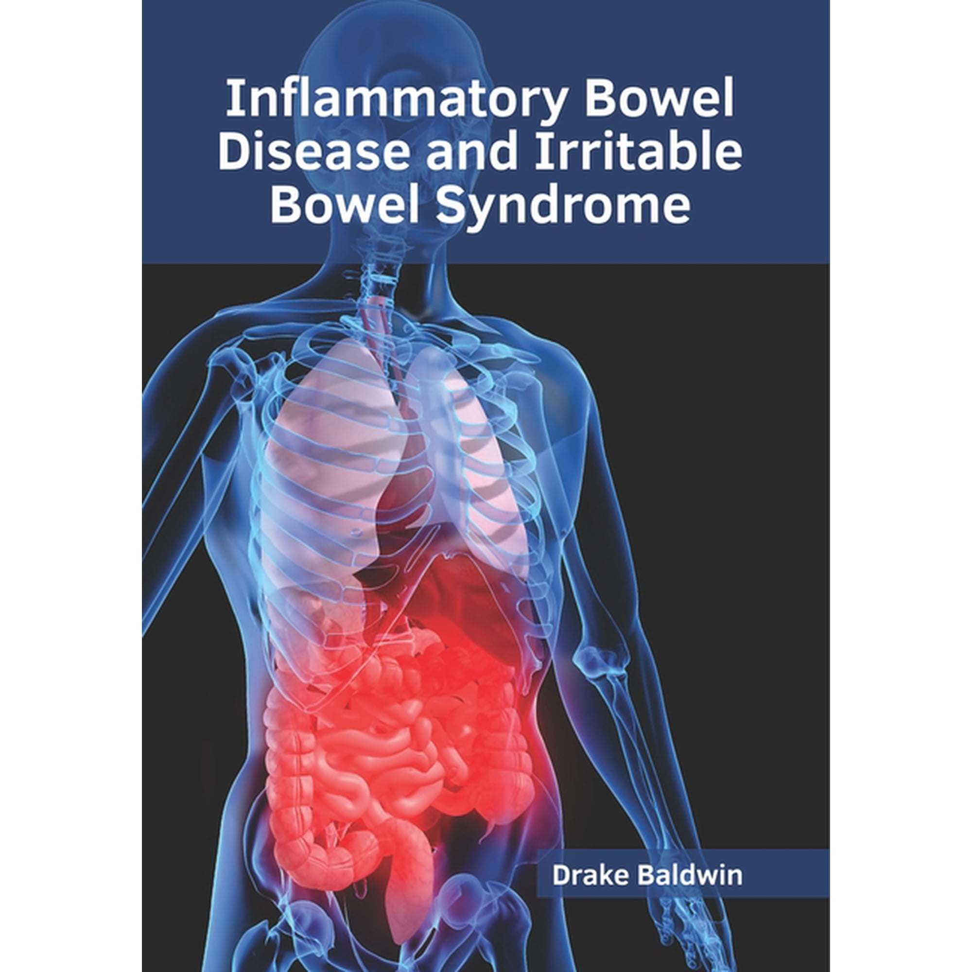 Inflammatory Bowel Disease and Irritable Bowel Syndrome, (Hardcover)