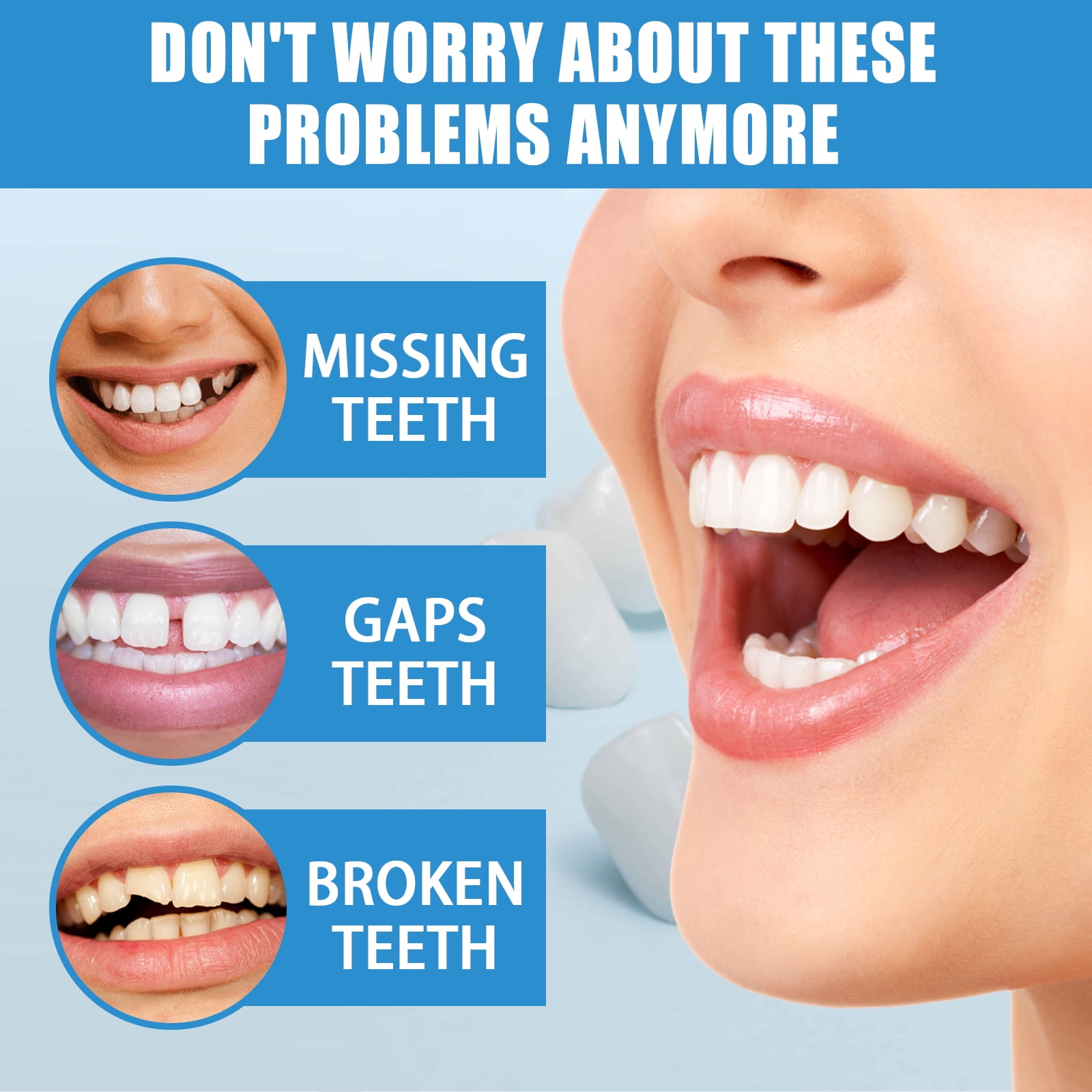 Alvantor Tooth Replacement Kit with Repair Beads for Missing and Broken Teeth, 1.05 oz, 8PC