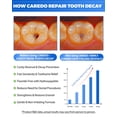 thumbnail image 3 of CAREDO Cavity Reversal Hydroxyapatite Toothpaste for Adults,  Remineralizing Toothpaste for Cavity Repair, Tooth Decay Repair and Sensitive Teeth Relief, Enamel Repair Fluoride-Free SLS-Free 3.52 oz, 3 of 10