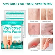 varicose veins post spider veins spider veins in legs edema neuralgia leg pain vasculitis improve blood circulation