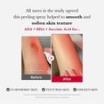 thumbnail image 2 of Limpiador corporal Medicube Red Body Peeling Shot 115 ml, 2 of 6