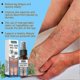 thumbnail image 3 of 1-3x Varicose Veins Treatments for Legs Smoothing Gentle Vein Healing Miracles Spray for Blood Vase Vasculitis Treatments, 3 of 5