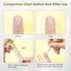 thumbnail image 5 of Aceite fortalecedor de uñas para hidratar y fortalecer las uñas. Aceite nutritivo para manicura. Lápiz para eliminar el exceso de uñas encarnadas. Lápiz para el cuidado de las uñas (2 ml)., 5 of 6