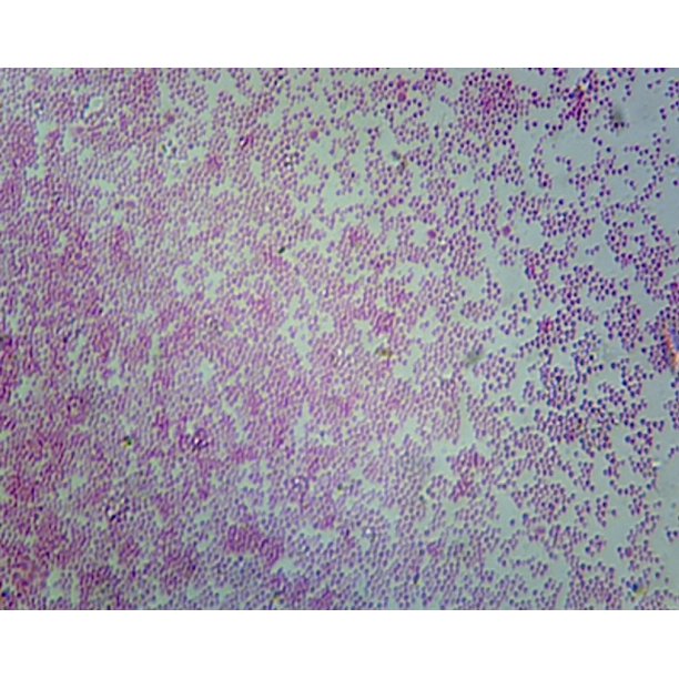 Gsc International Ps0356 Escherichia Coli Smear Gram Negative