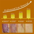 thumbnail image 4 of Crema para eliminar cicatrices de acné, 20g, crema facial para la piel, manchas de acné, crema para estrías anticicatrices, 4 of 7