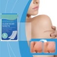 thumbnail image 1 of Scar Patch Soothing Relieving Inflammatory Hydrogel For Skin Recovery, 1 of 8