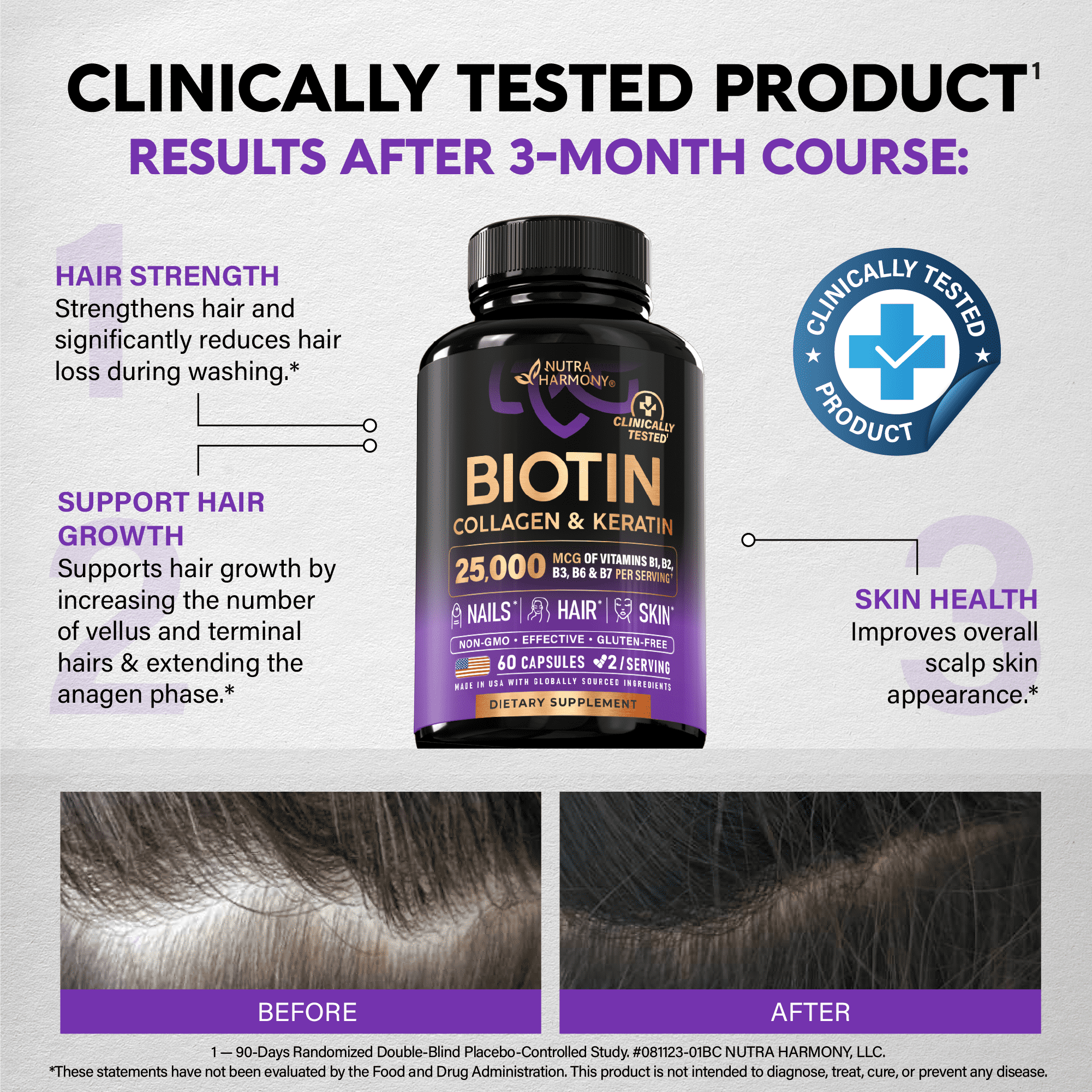 Biotin | Collagen | Keratin - Clinically Tested Supplement - Hair Growth Support, Skin & Nails - 25000 mcg Vitamins B2, B3, B6 & B7 + B1 & Hyaluronic Acid - Made in USA - Women & Men | 60 Capsules