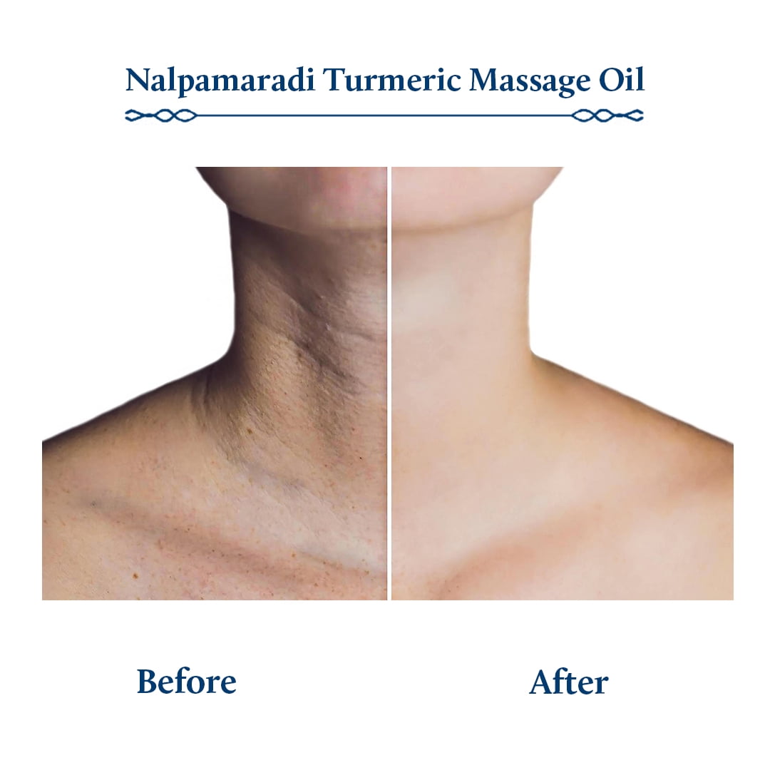 Blue Nectar Nalpamaradi Tailam Massage Oil for Skin Brightening Turmeric (6.76 fl oz)