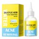 thumbnail image 1 of Buy 2 Save 10% 2% Salicylic Serum For Acne, Blackheads & Large Pores | Reduces Excess Oil & Uneven Skin110ml, 1 of 9