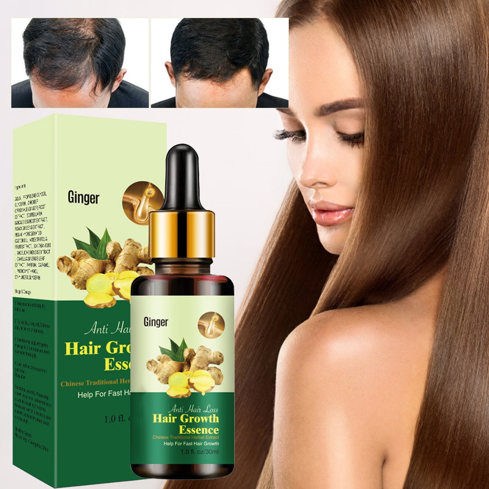 Hairole Ten 10 Days Hair Oil (For Men & Women) Hair Oil - Price in India,  Buy Hairole Ten 10 Days Hair Oil (For Men & Women) Hair Oil Online In India,
