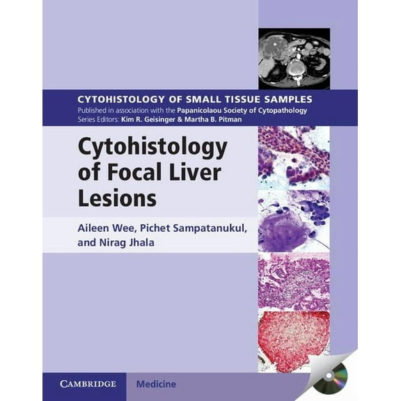 Cytohistology of Small Tissue Samples: Cytohistology of Focal Liver Lesions (Other)