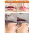 thumbnail image 4 of cremas depilatorias rápidas y suaves para el cuidado de la piel, blanqueamiento, depilación de labios y axilas, para belleza de mujeres, 4 of 4