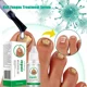 thumbnail image 2 of Hongos Extra para uñas, cuidado de reparación de uñas, eliminación de hongos para dedos de los pies, antiinfección, nuevo, 2 of 5