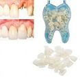 thumbnail image 2 of Temporary Dentures Occlusal Upper Dentures, Veneers, Missing Teeth, Broken Teeth And Interdental Spaces, Front Teeth + Back Teeth, 2 of 5