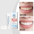 thumbnail image 5 of Stain-Removing Teeth Whitening Gel 30g – Concentrated Formula for Brighter Smile, Fights Surface Stains, Fresh Mint, 5 of 9