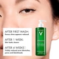 thumbnail image 2 of Paquete de cuidado de la piel VICHY Normaderm Daily Acne Face Wash + Hidratante, 2 of 9