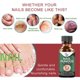 thumbnail image 5 of 50ML Nail Treatment Solution Nail Repair Liquid Accelerate Metabolism Onychomycosis Treatment Solution, 5 of 5