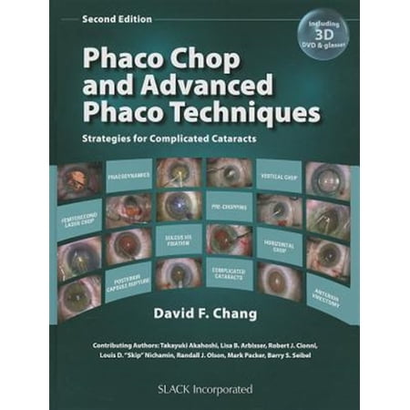 Pre-Owned Phaco Chop and Advanced Phaco Techniques: Strategies for Complicated Cataracts (Paperback)