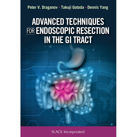 Advanced Techniques for Endoscopic Resection in the GI Tract (Hardcover)