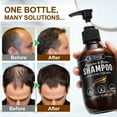 thumbnail image 6 of Rtbyue 2-Pack Caffeine Hair Care Shampoo for Men & Women,Strengthens Hair, Biotin Shampoo, 6 of 9