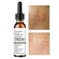 thumbnail image 3 of Solución de ácido salicílico al 2 % para eliminar manchas de acné, reducir los poros, controlar la grasa y aclarar la piel del rostro. Suero de vitamina C para el rostro, 3 of 6