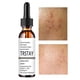 thumbnail image 3 of Solución de ácido salicílico al 2 % para eliminar manchas de acné, reducir los poros, controlar la grasa y aclarar la piel del rostro. Suero de vitamina C para el rostro, 3 of 6