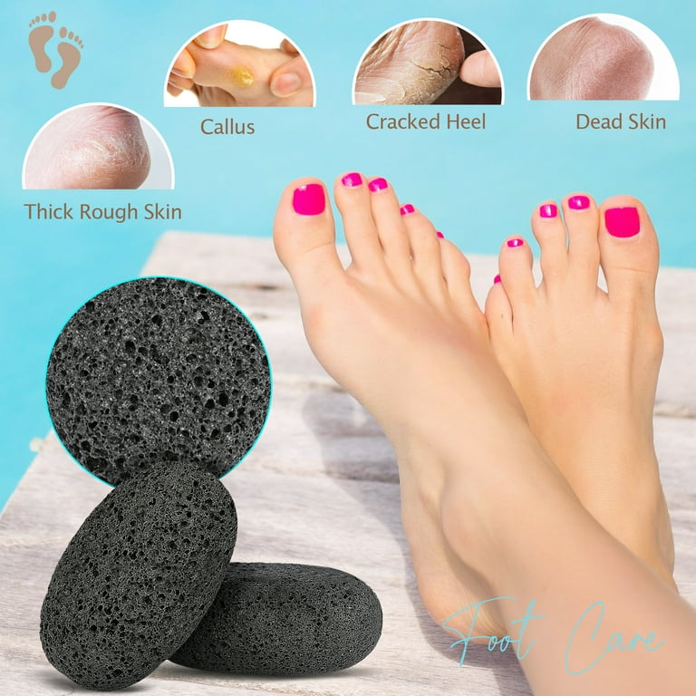 Salvmary 2 Pcs Pumice Stone for Feet Foot Scrubber for Hard Skin Pedicure Care Stone, Black
