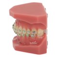 thumbnail image 4 of Modelo de demostración de ortodoncia dental Modelo de dientes con alambres de metal y soporte para enseñanza y aprendizaje, 4 of 15