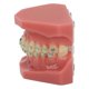 thumbnail image 4 of Modelo de demostración de ortodoncia dental Modelo de dientes con alambres de metal y soporte para enseñanza y aprendizaje, 4 of 15