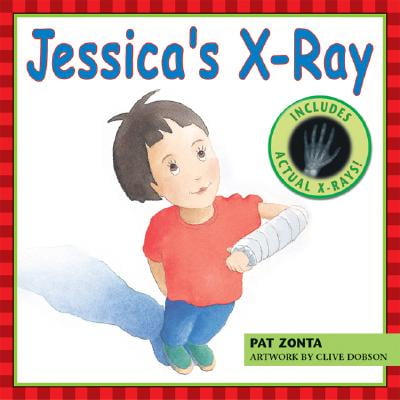 X-ray Steering - Jessica's X-Ray